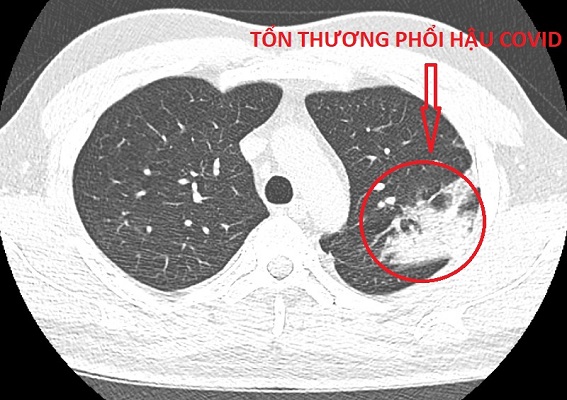 Dịch vụ chụp cắt lớp vi tính tại Bệnh viện Đa khoa Lâm Hoa